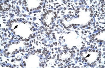 CITED1 Antibody