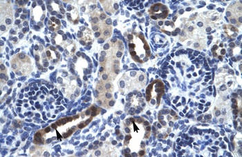 TSFM Antibody