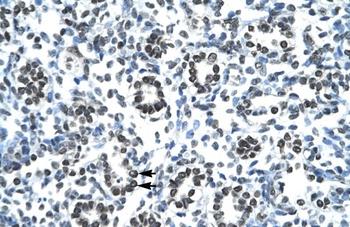 HOXB9 Antibody