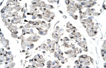 TBX21 Antibody