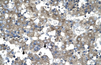 KLF15 Antibody