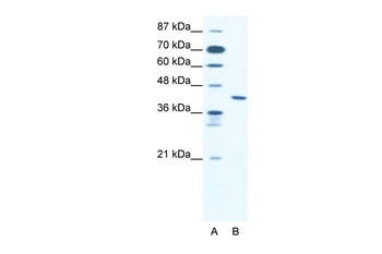 ZNF621 Antibody
