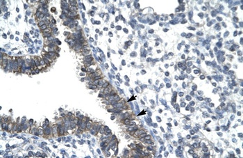CCRN4L Antibody