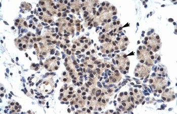 ZNF318 Antibody