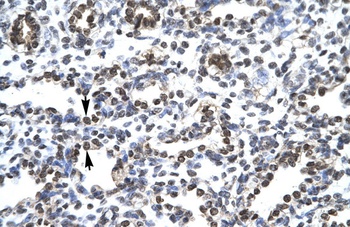 CIon Channel Antibody