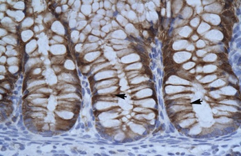 SUV39H1 Antibody