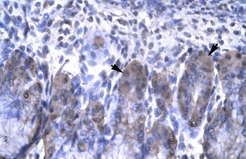 OTX2 Antibody