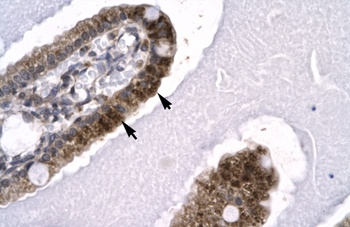SKIIP Antibody