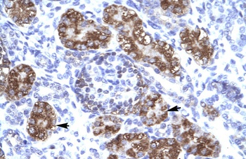 ZNF409 Antibody