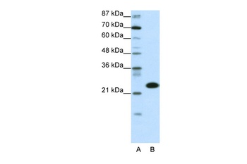 TAF11 Antibody