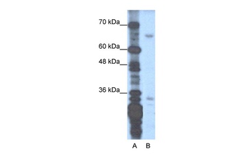 ZNF691 Antibody