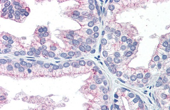 NAB1 Antibody