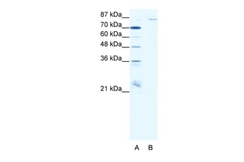 MEFV Antibody