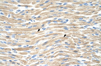 LMX1A Antibody