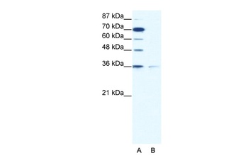 ZNF326 Antibody