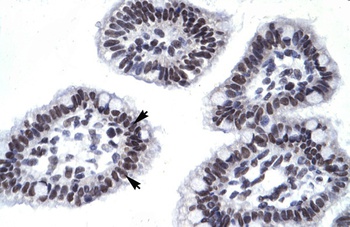 AATF Antibody