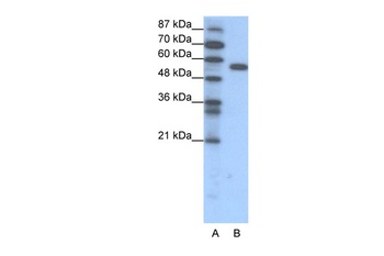 FOXC2 Antibody