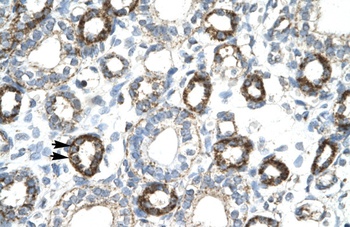 FOXF2 Antibody