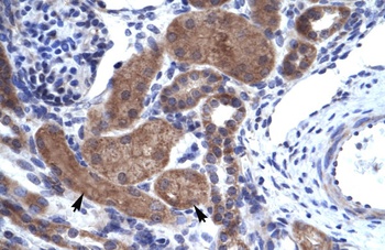 IKZF2 Antibody