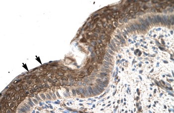 ZFP1 Antibody