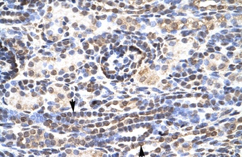 KLF9 Antibody