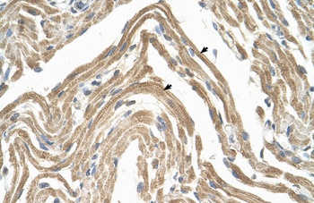 CCBP2 Antibody