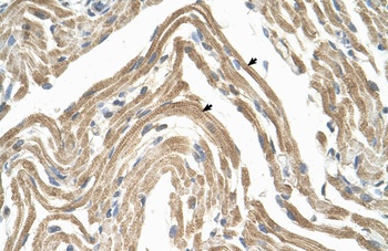 ACKR2 Antibody