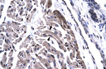 TAF15 Antibody