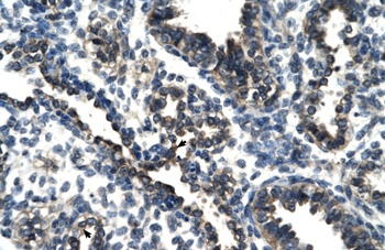 TSC22D4 Antibody