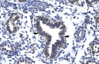 RBM10 Antibody