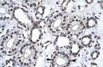 RBM10 Antibody