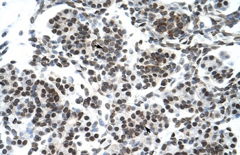 ZNF394 Antibody