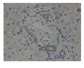 GLIS2 Antibody