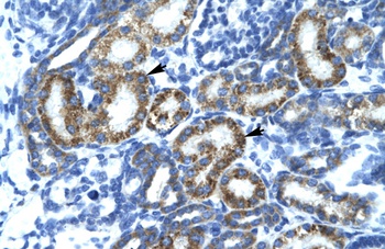 FIZ1 Antibody