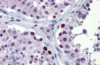 NFX1 Antibody