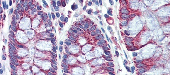 PGLS Antibody