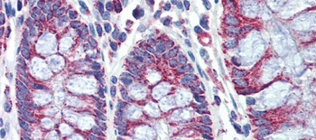 PGLS Antibody