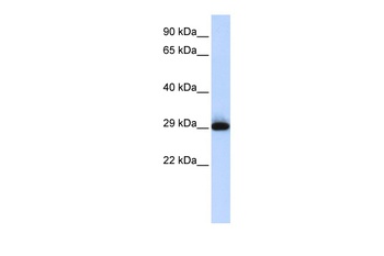 SUSD3 Antibody