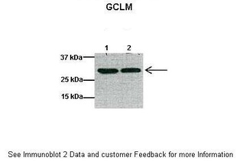 GCLM Antibody