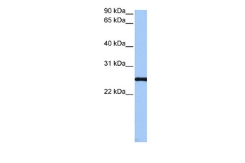 CCDC46 Antibody