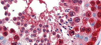 TKTL1 Antibody