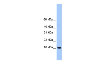 TRAPPC6B Antibody