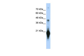 C17orf49 Antibody