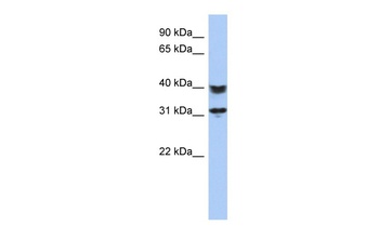 SETD9 Antibody