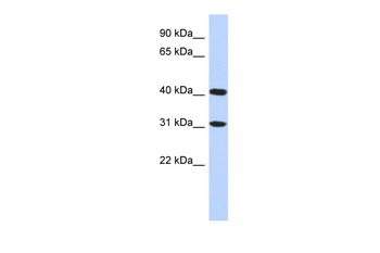 FAM46D Antibody