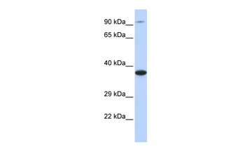 BBS5 Antibody