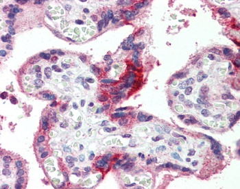 GPSM2 Antibody