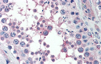 MED4 Antibody