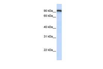 TMEM168 Antibody