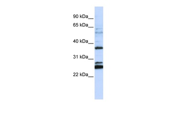 TMEM255A Antibody